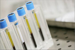 Endoret PGRF - Suero Autólogo Enriquecido - VERTE Oftalmología Barcelona