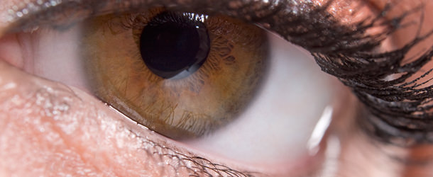 Dilated pupil - VERTE Oftalmología Barcelona
