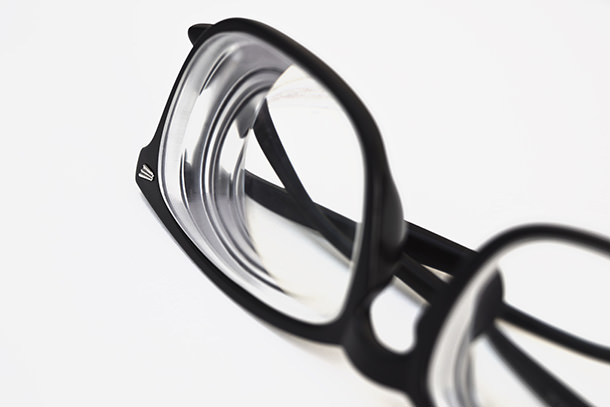 Alta miopía - Glaucoma - VERTE Oftalmología Barcelona
