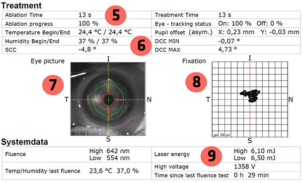 Cirugía Laser - Laser Amaris - Astigmatismo y Miopía - IO·ICO
