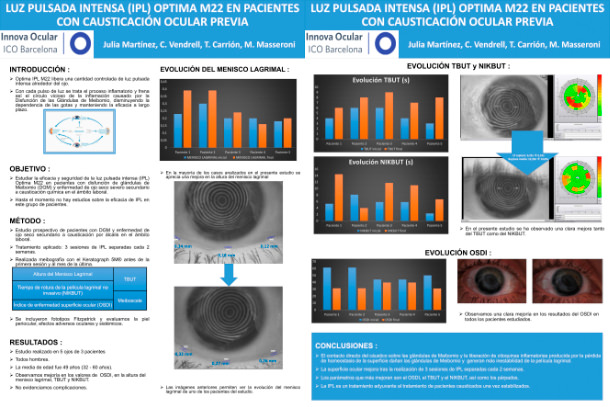 Premio SCOFT - Mejor poster - IPL - VERTE Oftalmología Barcelona