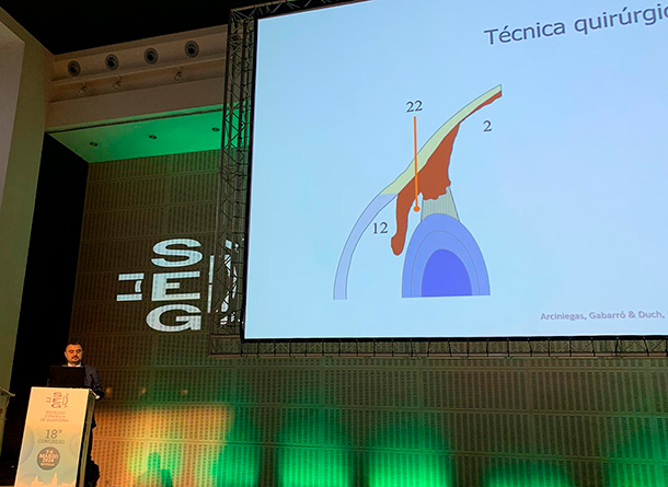 Dr. Carlos Arciniegas - Glaucoma - SEG 2024