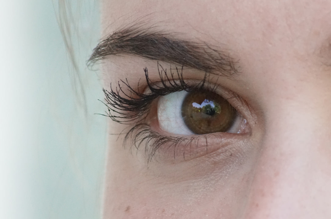 Consells de prevenció alergia ocular- VERTE Oftalmologia Barcelona