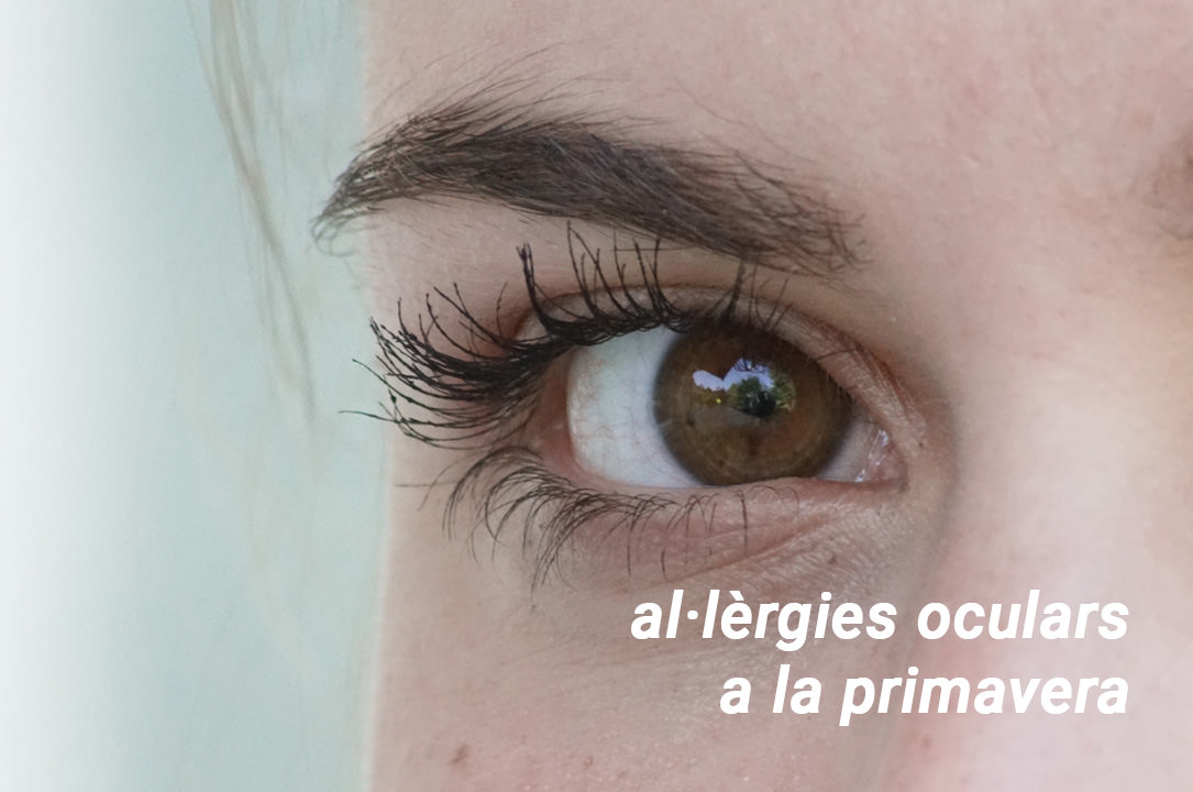 Consells de prevenció al·lèrgia ocular- VERTE Oftalmologia Barcelona