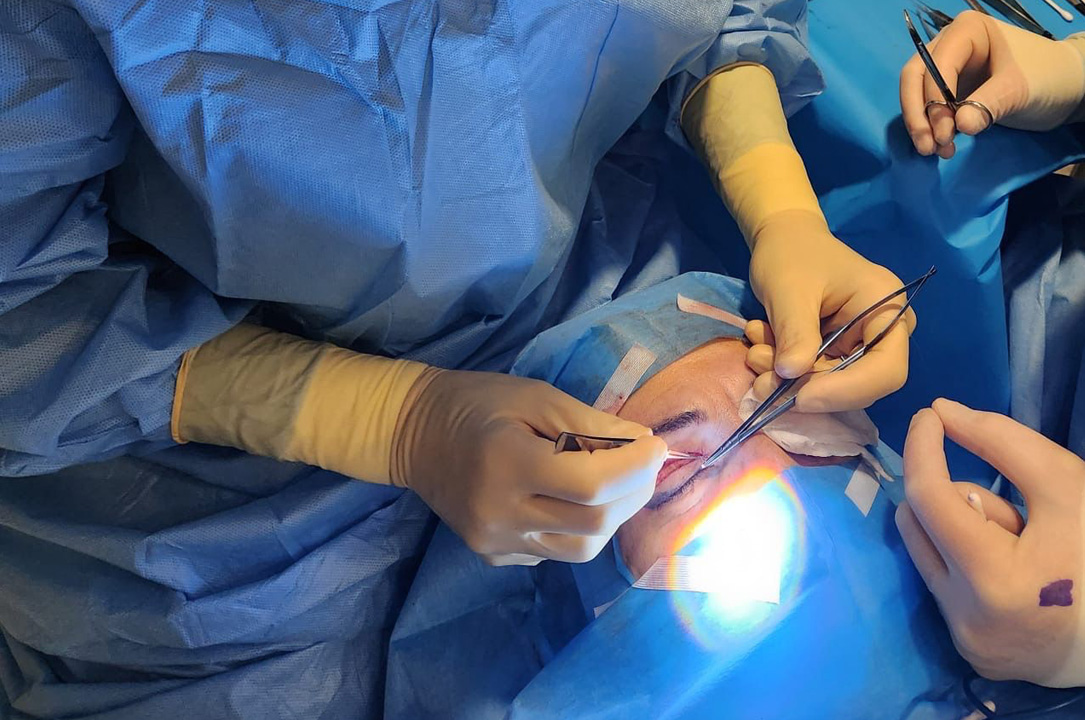 Cantoplexia - Operación