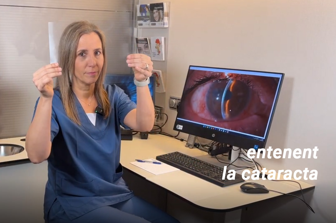 Dra. Magela Garat - Especialista en cataractes oculars