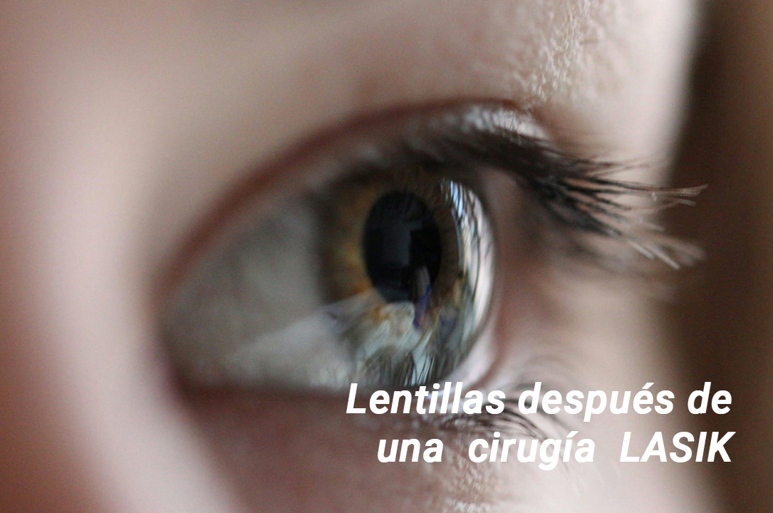 Lentillas después del LASIK