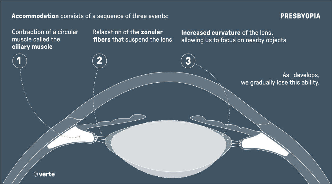Presbyopia - Tired Sight - VERTE Ophthalmology Barcelona