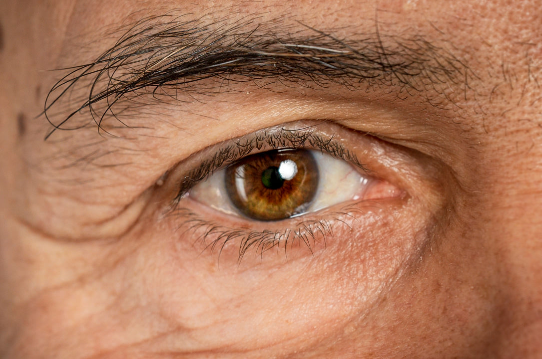 Revisión Ocular - VERTE Oftalamología Barcelona