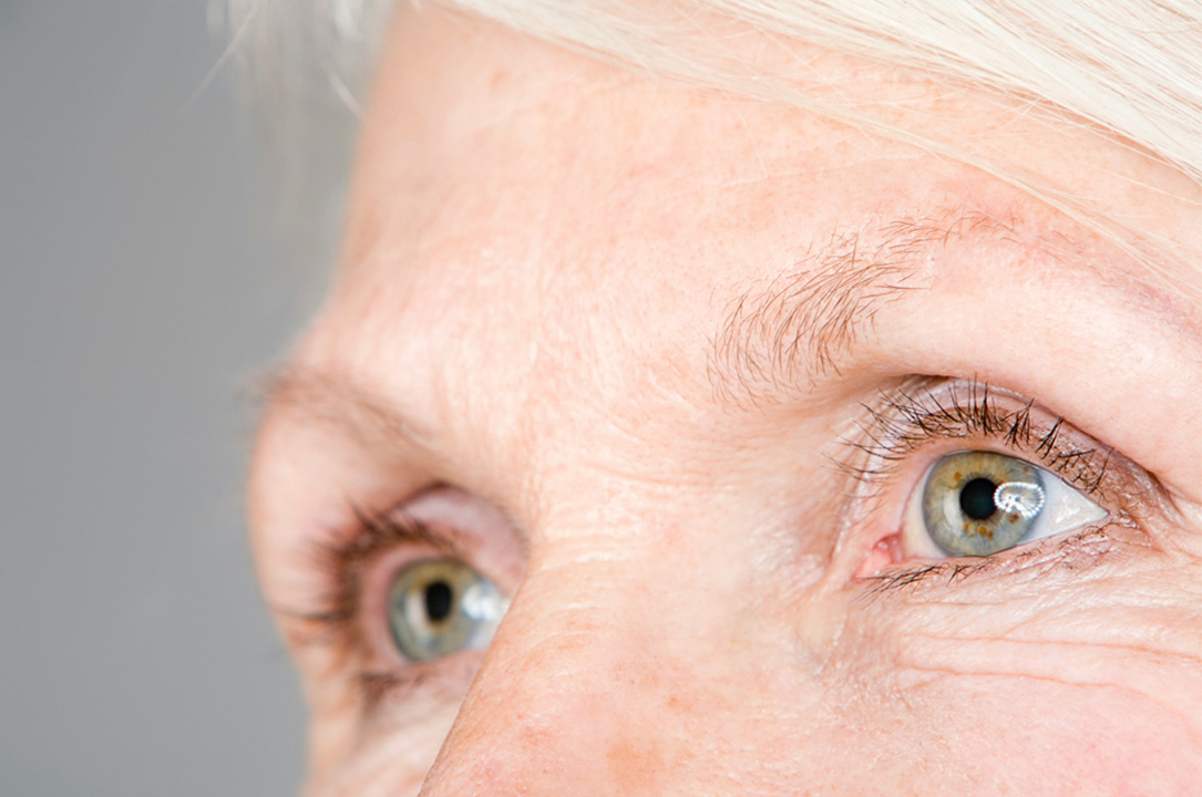 Semana Mundial Glaucoma 2025 - VERTE Oftalmología Barcelona